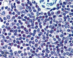IHC testing of FFPE human spleen (nucleoli staining) with HMG20A antibody at 2.5ug/ml. HIER: steamed