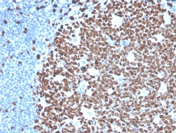 IHC staining of FFPE human tonsil tissue with recombinant Ki-67 antibody (clone MKI67/4945R). HIER:
