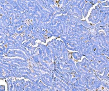Prothrombin Antibody