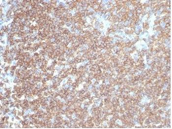 IHC staining of FFPE human tonsil tissue with recombinant CD45RA antibody (clone rPTPRC/7283). HIER: