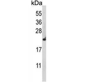 RPL18A Antibody