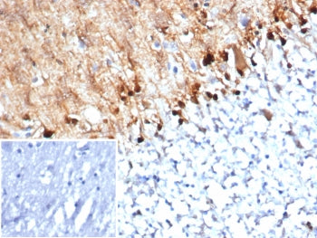 S100B Antibody