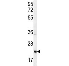 Western blot testing of mouse bladder tissue lysate with ASCL2 antibody. Predicted molecular weight