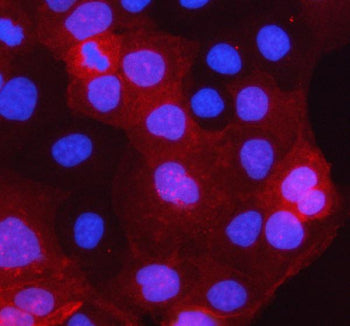 Immunofluorescent staining of STARD10 using anti-STARD10 antibody (red). STARD10 was detected in an