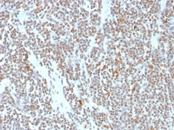 ATRX Antibody / RAD54