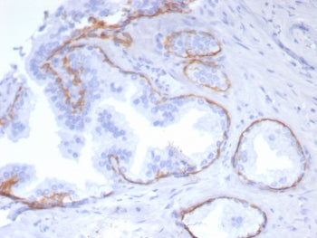 Cytokeratin 5 Antibody / KRT5