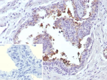 MRP4 Antibody / ABCC4