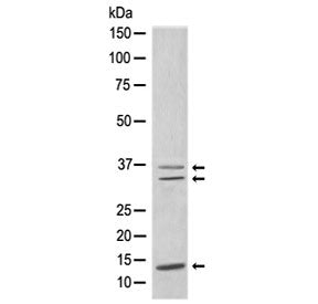 CEBPB Antibody