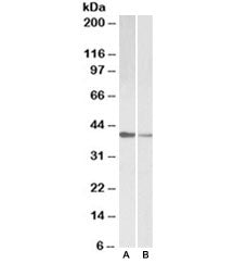 TNNT2 Antibody