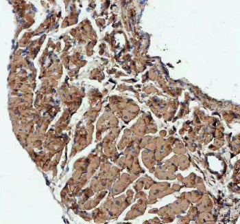 IHC staining of FFPE mouse heart tissue with Actin antibody. HIER: Boil the paraffin sections in pH8