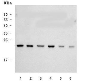 Sigma-2 Receptor Antibody / SR2 / MAC30 / TMEM97