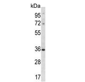 DLX5 Antibody