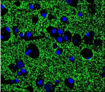 Immunofluorescent staining of human brain tissue with Synaptophysin antibody (green) and DAPI nuclea