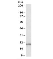 EIF5A Antibody