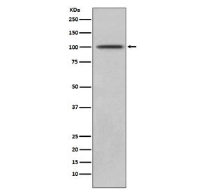 CD10 Antibody / Neprilysin