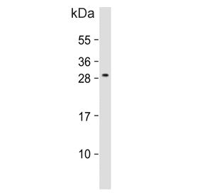 ALKBH6 Antibody