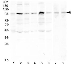 Western blot testing of human 1) placenta, 2) HeLa, 3) PC-3, 4) A431, 5) K562, 6) PANC-1, 7) rat tes
