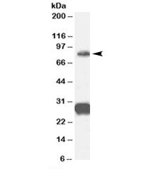 Western blot testing of human cerebellum lysate with FOXP2 antibody at 0.3ug/ml. Predicted molecular