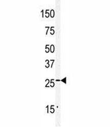 Claudin 2 Antibody