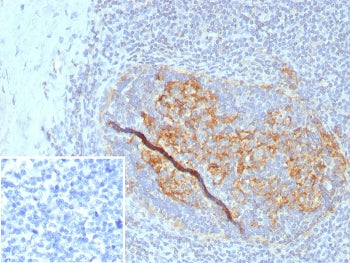 CD35 Antibody / CR1