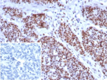 MSH6 Antibody