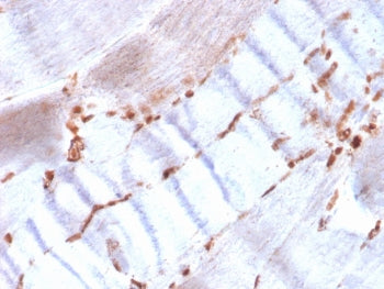 IHC staining of FFPE human skeletal muscle with recombinant Actin antibody (clone ACTA2/1614R). HIER