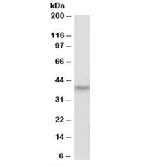 HOXA10 Antibody
