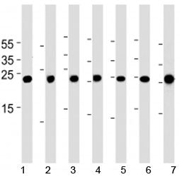 Cebpd antibody western blot analysis in 1) A549, 2) HeLa, 3) NCI-H460, 4) U-937, 5) mouse NIH3T3 cel