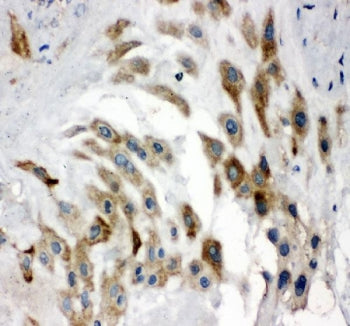 Noggin Antibody