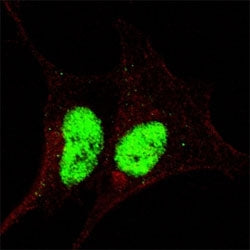 Phospho-SOX2 Antibody (pS246)
