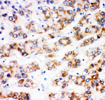 AFP Antibody