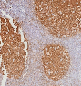 POU2AF1 Antibody / BOB-1