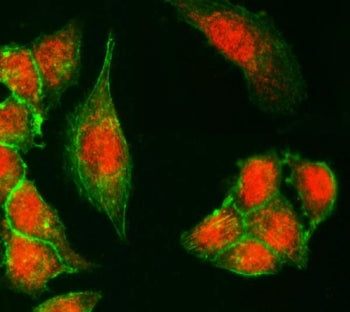 KDM6A Antibody