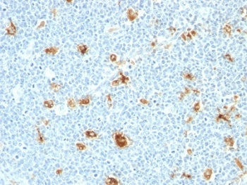 Calgranulin A/B Antibody / S100A8/A9 / Calprotectin