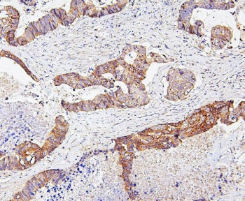 SKP1 Antibody