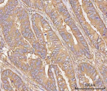 PPP3CB Antibody / Calcineurin A beta