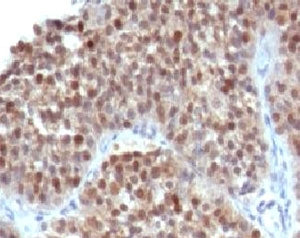 p21 Antibody / CDKN1A