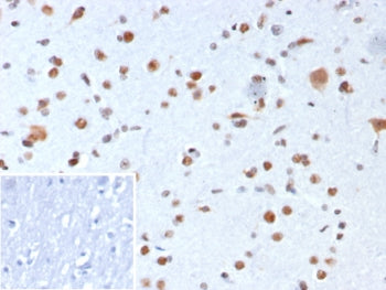 IHC staining of FFPE human brain tissue with NPM1 antibody (clone rNPM1/8056). Inset: PBS used in pl