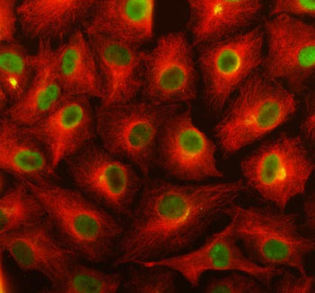 Immunofluorescent staining of TSR1 using anti-TSR1 antibody (green) and anti-Alpha Tubulin antibody