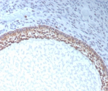 AMH Antibody / Anti-Muellerian Hormone