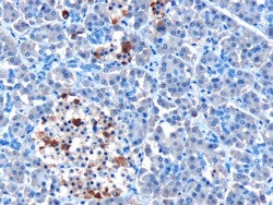 MDA-5 Antibody