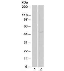 CSNK1E Antibody