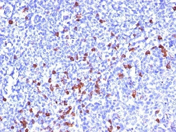 Kappa Light Chain Antibody