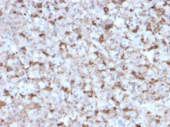 IHC testing of FFPE human pituitary tissue with Prolactin antibody (clone PRL/2643). Required HIER: