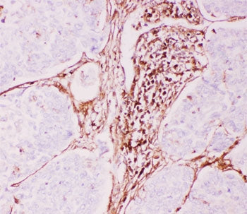 P Glycoprotein Antibody