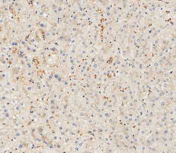 IHC testing of FFPE human liver tissue with HPX antibody. HIER: steam section in pH9 EDTA for 20 min