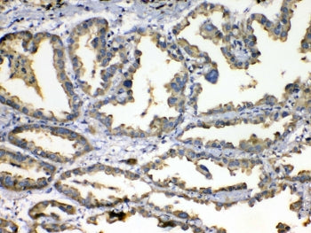 Superoxide Dismutase 3 Antibody / SOD3
