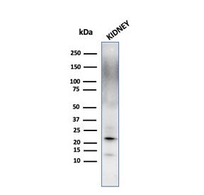 Western blot testing of human kidney lysate with Ferritin Light Chain antibody. Predicted molecular