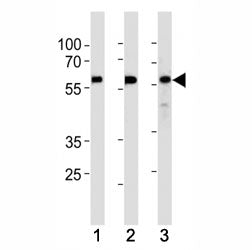 KLF4 antibody western blot analysis in (1) HeLa,(2) MCF-7 and (3) SW480 lysate. Predicted molecular