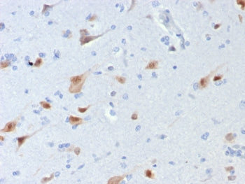 IHC staining of FFPE human brain tissue with NeuN antibody (clone rNEUN/8054). HIER: boil tissue sec